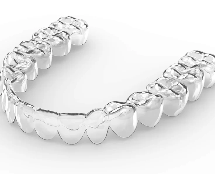 clear aligner